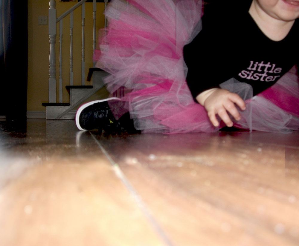 Lilybear, and the Quest of Congenital Talipes Equinovarus Lilybear's