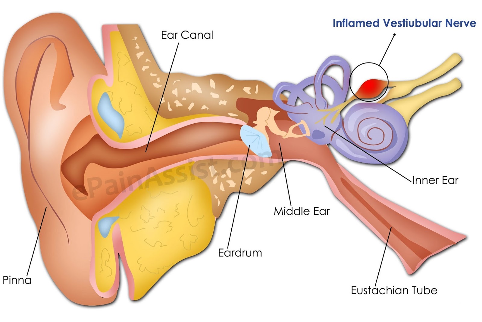 Нервы органа слуха. Нейропатия слухового нерва. Неврит слухового нерва (кохлеарный неврит). Слуховой нерв анатомия физиология. Неврит слухового нерва анатомия.