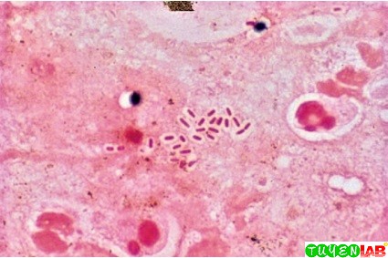 microbiology atlas of direct examination in selected gram klebsiella pneumoniae gram stain