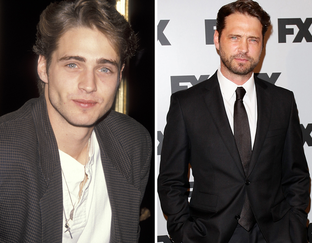 Jason Priestley Plastic Surgery