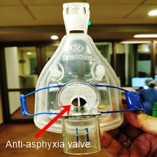anti-asphyxiation valve for pediatric niv masks