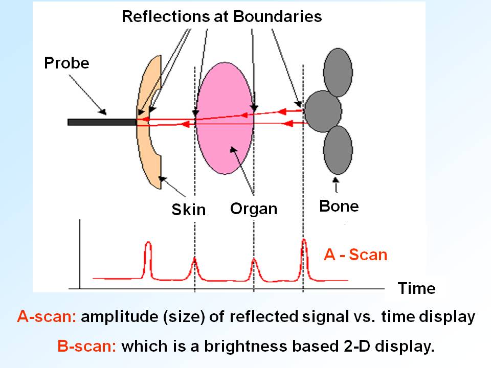 ektalks Medical Imaging Ultrasound Imaging; On the nature of sound waves