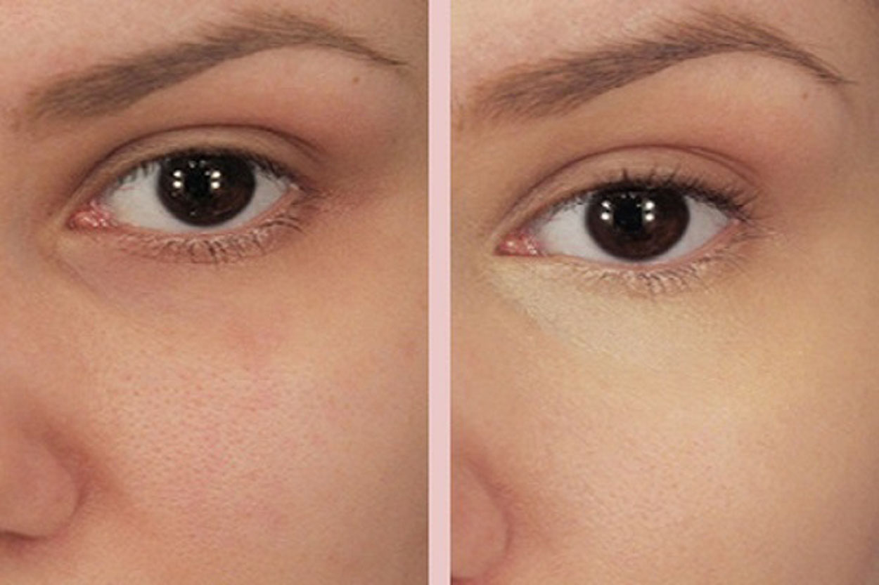 Dark circles. Примочки из пищевой соды под глаза. Глаз сода. Сода от темных кругов под глазами. Осветление темных кругов под глазами.