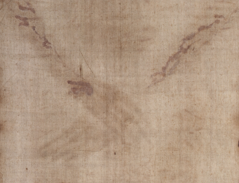 The Shroud of Turin:  Christ's Evidence of the Resurrection - Page 4 NailWoundDurante