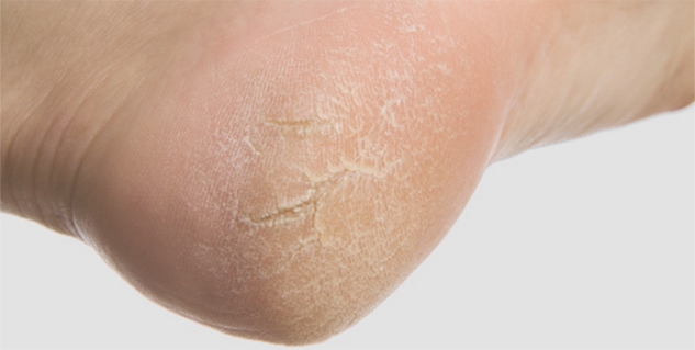 These symptoms of the feet can make you lucky These symptoms of the feet can make you lucky