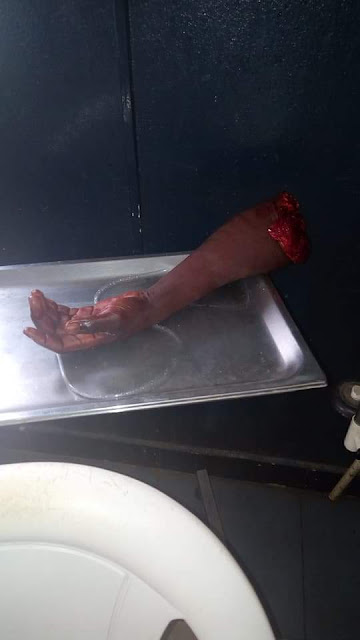 Graphic photos: Man dies in Anambra after his brother chopped off his hand over land dispute