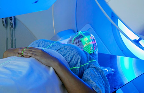A Woman Receiving Radiation Therapy
