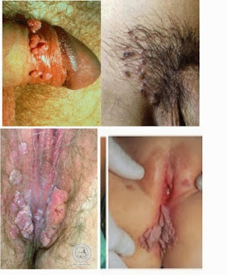 Teen musclemen bodybuilder groups Extreme anal on the beach