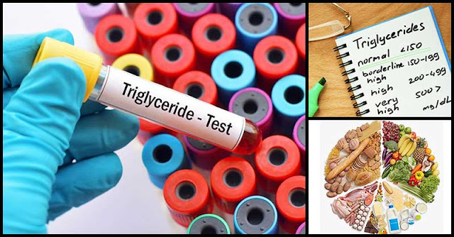 How To Lower Triglyceride Levels Naturally? How To Lower Triglyceride Levels Naturally?