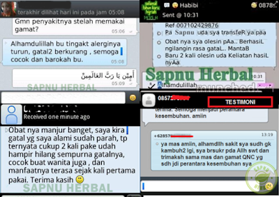 Cara Mengatasi Kulit Kepala Kering, Gatal, Berkerak Dan Mengelupas Cara Mengatasi Kulit Kepala Kering, Gatal, Berkerak Dan Mengelupas