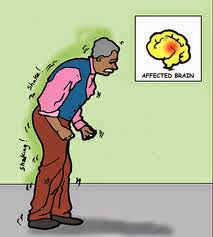 Η κατάθλιψη στη νόσο του Πάρκινσον