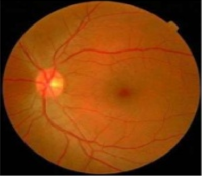 retina scan image