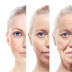 So sánh công nghệ trẻ hóa da DiCELL và Thermage