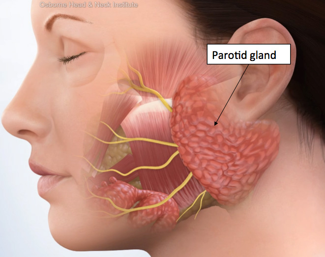 MT Endangerment Sites: 17. Parotid Salivary Gland