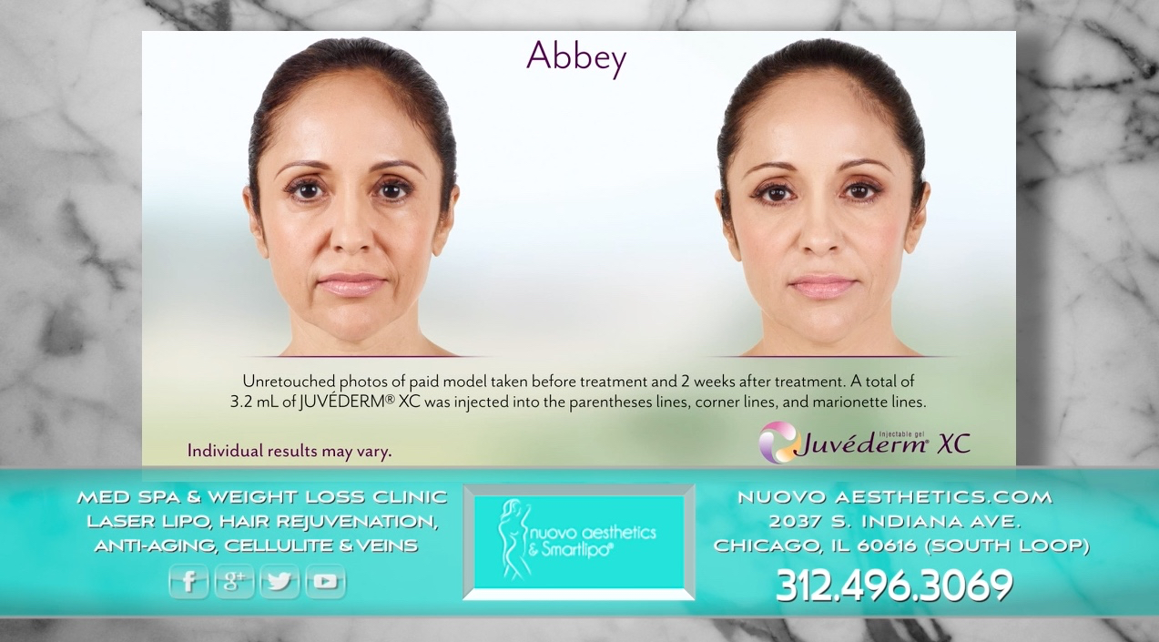 Skincare Chicago Lip Injections Chicago South Loop