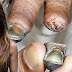 World’s 10 Most Deadly Street Drugs that Will Quickly Tear Your Body Apart