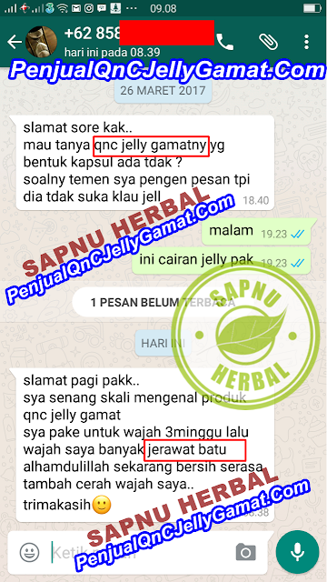 Obat Jerawat Batu Yang Dioles, Salep AMPUH Menyembuhkan Jerawat Batu / Acne conglobata Secara Alami Obat Jerawat Batu Yang Dioles, Salep AMPUH Menyembuhkan Jerawat Batu / Acne conglobata Secara Alami