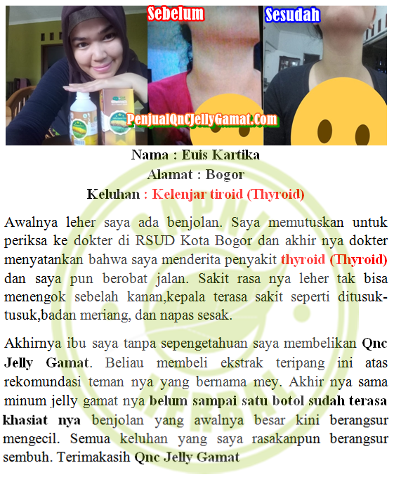 Biaya Operasi Kelenjar Tiroid Di Leher Tahun Ini 2019 ~ TESTIMONI QNC JELLY GAMAT Biaya Operasi Kelenjar Tiroid Di Leher Tahun Ini 2019 ~ TESTIMONI QNC JELLY GAMAT
