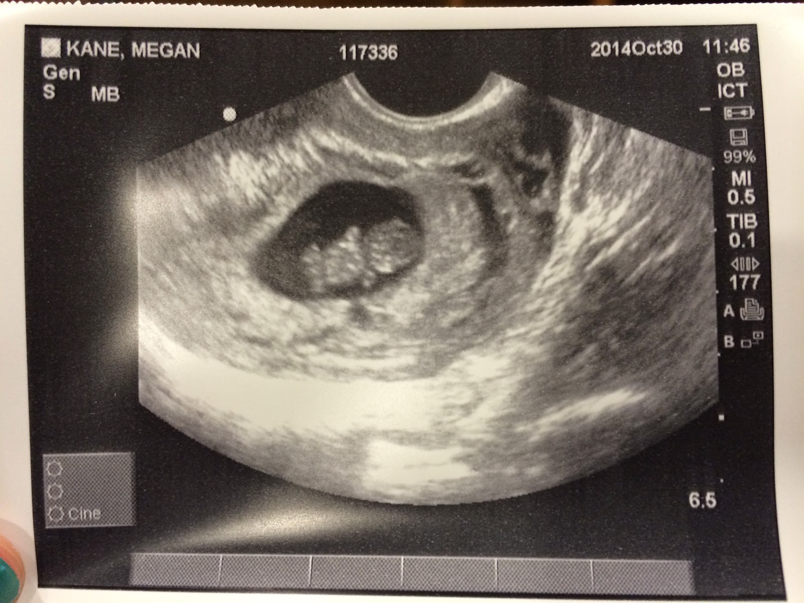 make bake and love Hello There! + 20 Weeks with the Gummy Bear