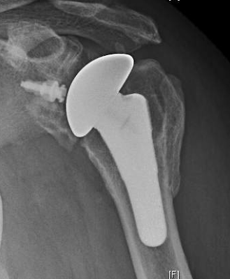 seneca moral essays volume i loeb classical library no 214