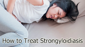 How to Treat Strongyloidiasis How to Treat Strongyloidiasis