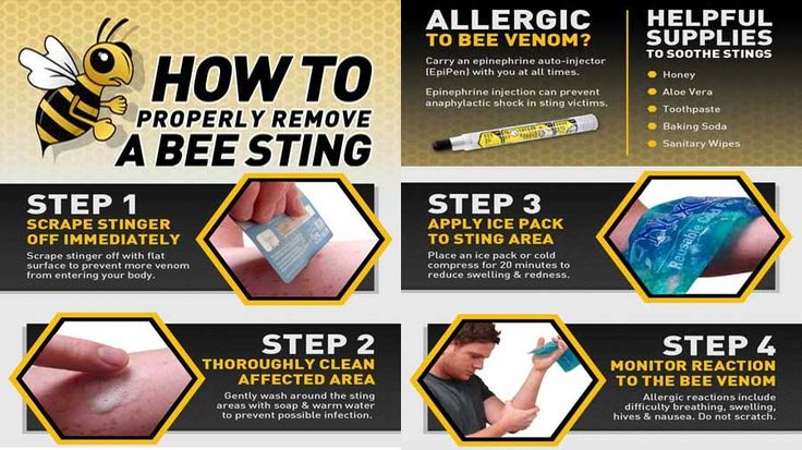 first-aid-for-bee-stings-news-of-the-world-top-hollywood-celebrity