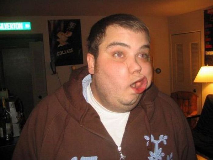 Stressy World Funny Online Ugliest Facial Expression Contest (20 Pics)