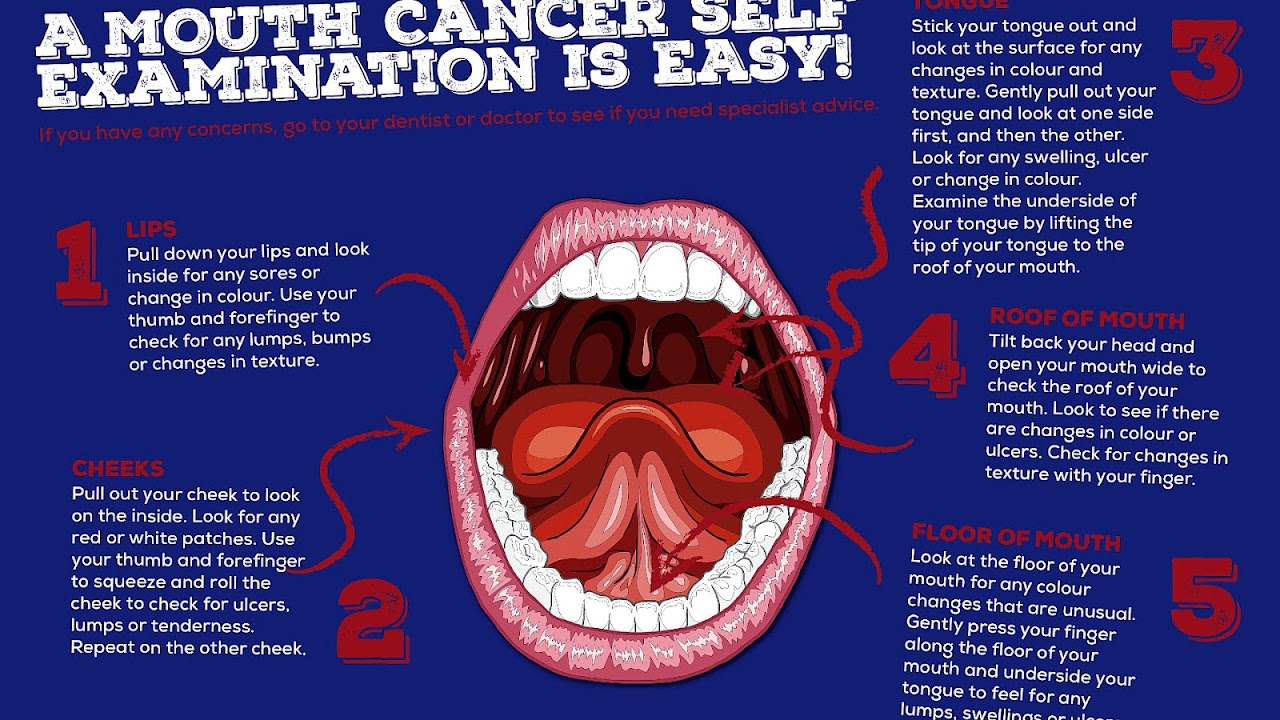 white-patches-in-mouth-white-choices