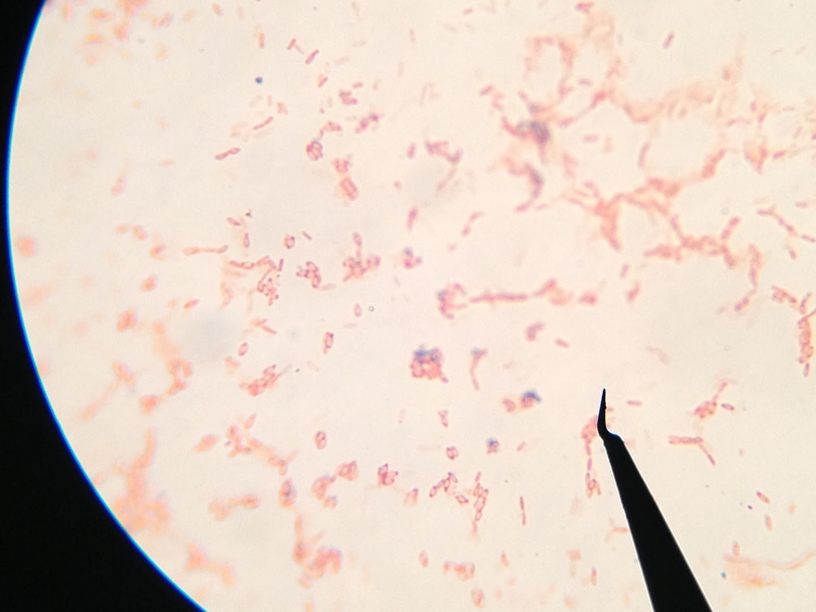 Ari and Johanna's Medical Microbiology Lab Report Gram Staining