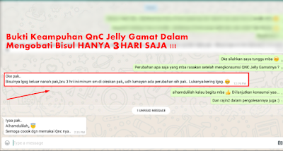 Cara Mengeringkan Bisul Yang Sudah Pecah Dengan Cepat Tanpa Membekas Cara Mengeringkan Bisul Yang Sudah Pecah Dengan Cepat Tanpa Membekas