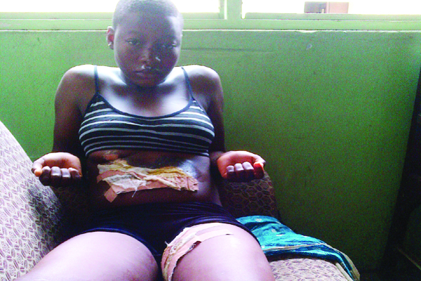 girl tortured hot iron aunt ketu lagos