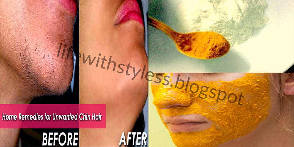 Top Home Remedies to Remove Unwanted Chin Hair Life With Styles