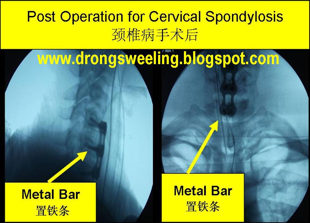 TCM News Best TCM Doctors for Neck Pain, Back Pain, Knee Pain, Trigger