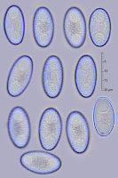 Pachyella pseudosuccosa 