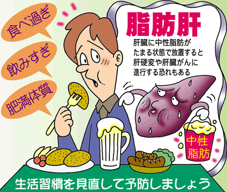 アルコール性脂肪肝とは|症状・原因・治し方(禁酒・食事・運動)