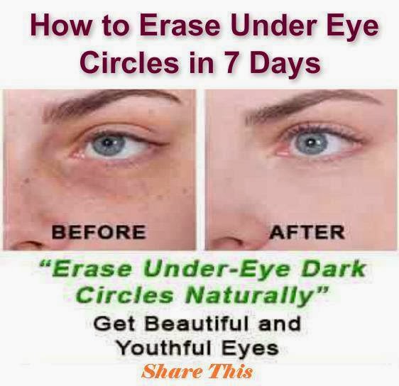 How to Erase Under Eye Circles in 7 Days Useful Information