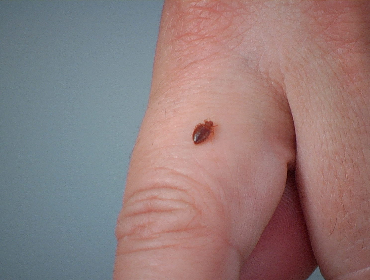 How to Get Rid of Chiggers