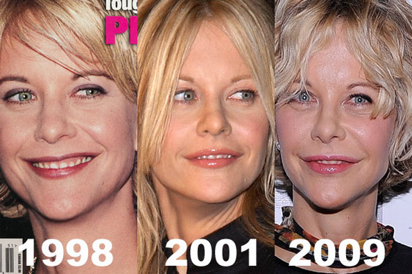 Plastic Surgery