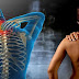 FIBROMIALGIA: DOLOR E INCAPACIDAD