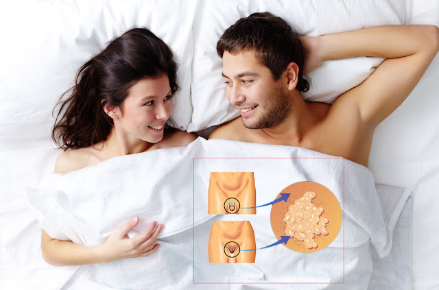 Treatments For HPV Treatments For HPV