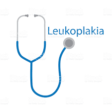 leukoplakia-www.healthnote25.com