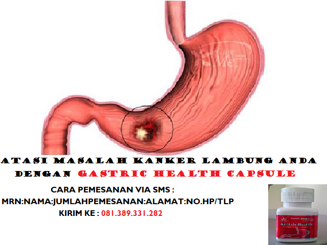 Ciri Gejala penyakit Kanker Lambung - Cara mengobati maag Kronis