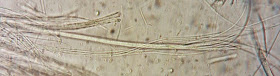 Schizoxylon alboatrum and filiform ascus and spores