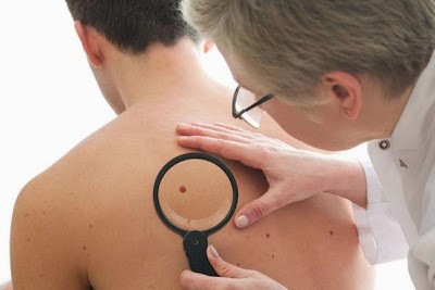 Revisión dermatológica para prevenir problemas