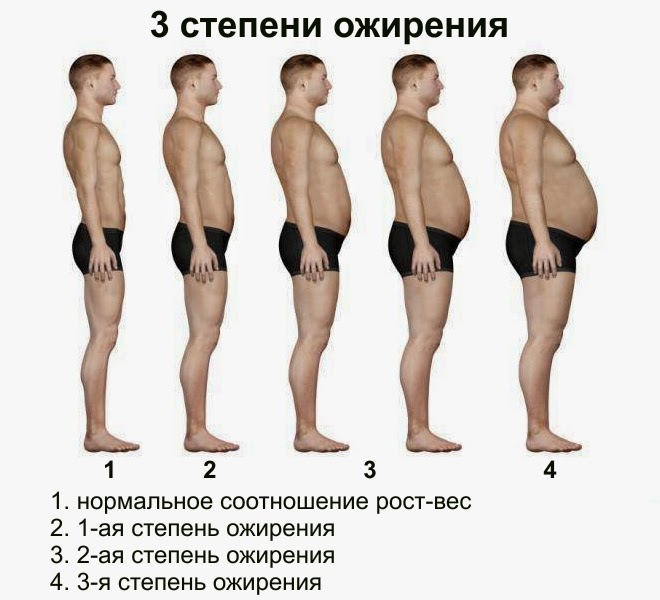 obesity-7.jpg