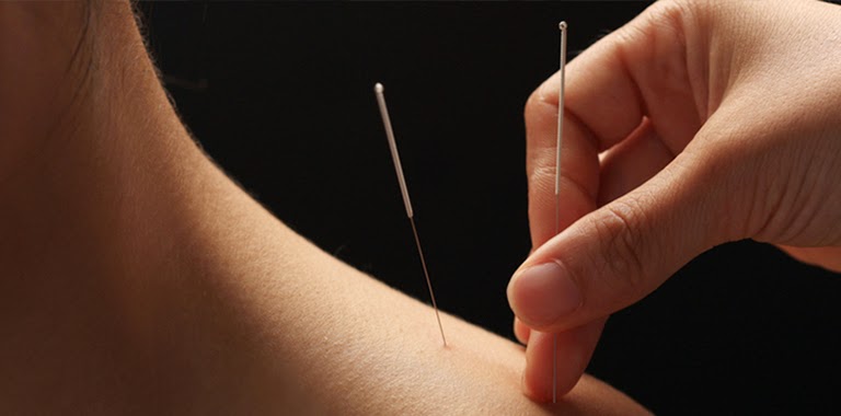 http://acupunturavitalmadrid.com/tecnicas_medicina_china.html