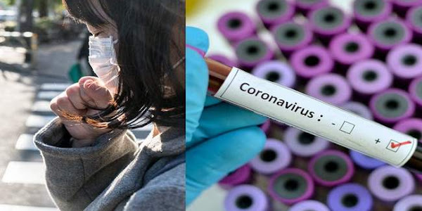 नोवल कोरोना वायरस से बचाव के लिये प्रदेश में हाई अलर्ट जारी