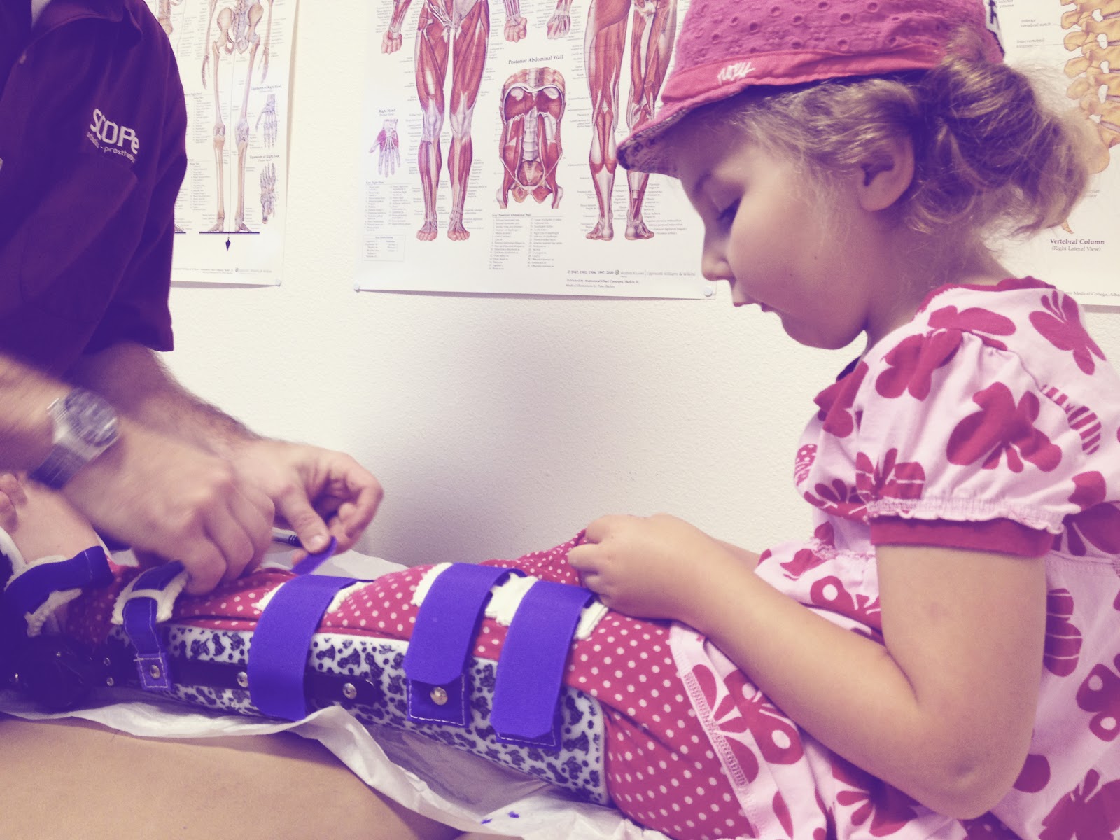 Beebs and Bro New leg brace