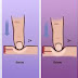 Common Causes And Remedies For Water Retention