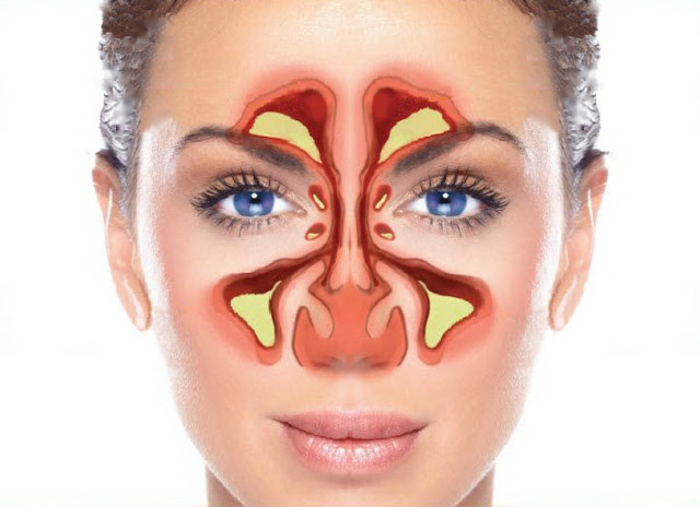 5 Hal yang Menjadi Penyebab Sering Sakit Kepala 5 Hal yang Menjadi Penyebab Sering Sakit Kepala